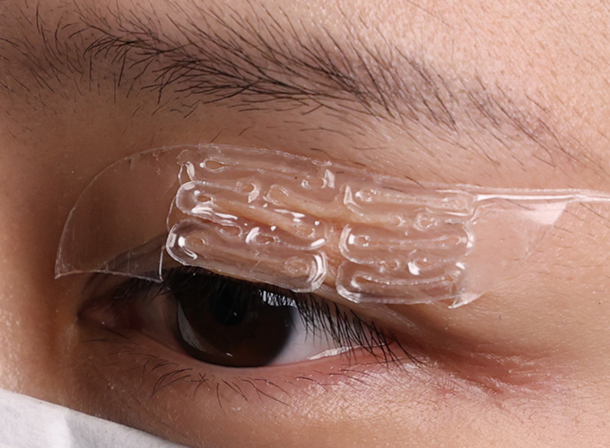 Eyelid Assistive Device